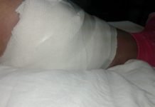 El drama de una joven madre internada en el Hospital por salvar a su hijo de la mordedura de un perro