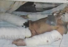 La problemática de los perros sueltos en la vía pública asì en Las Heras como en Comodoro